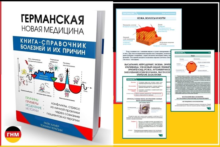 Аллергия на солнце