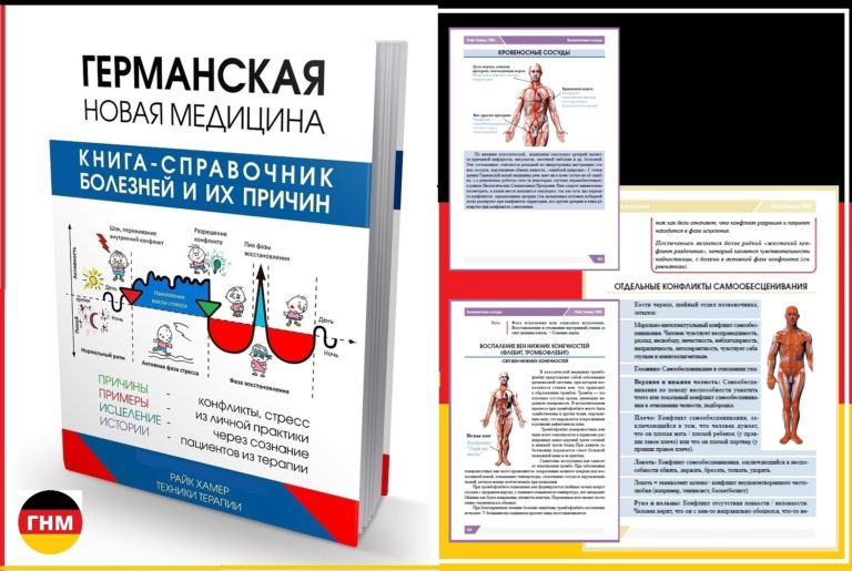 Как избавиться от варикоза