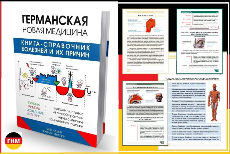 Болит спина причины