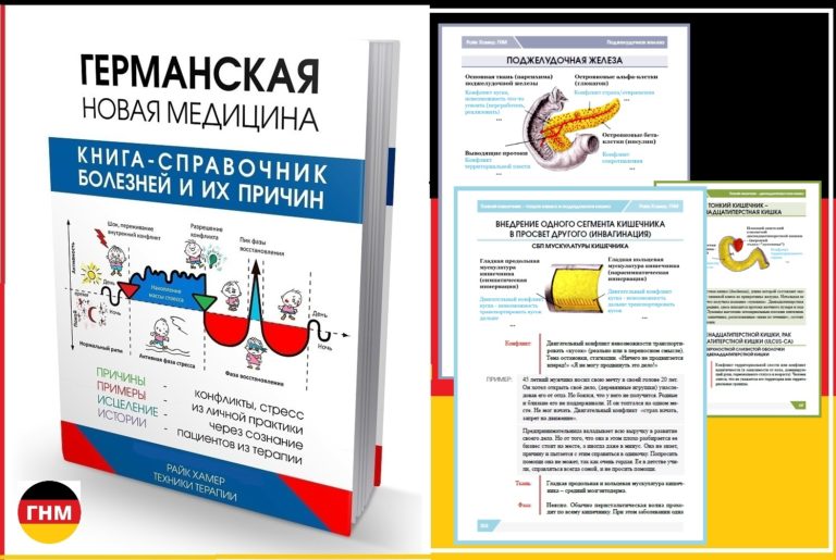Как лечить геморрой