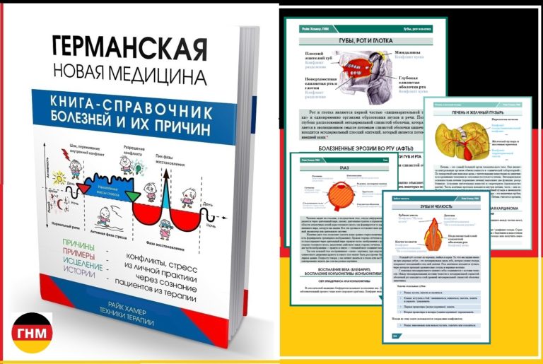Аденоиды у ребенка