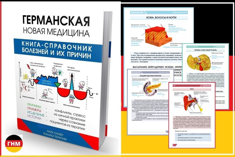 Экзема на теле