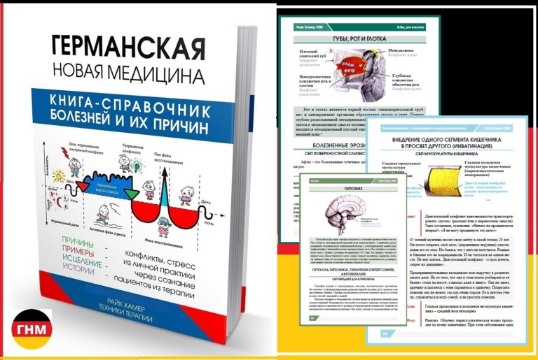 Заболевание красная волчанка