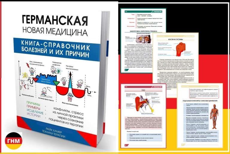 Болезнь витилиго