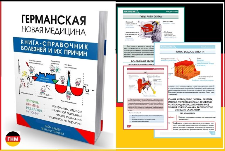 Почему дети болеют в саду