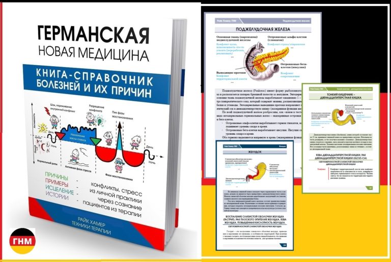 Кишечная непроходимость симптомы