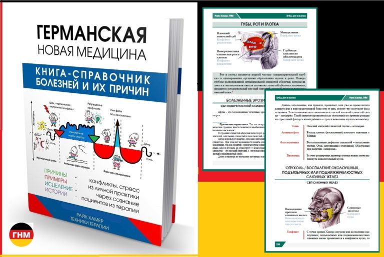 Гайморит воспаление носа