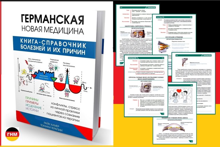 Близорукость, ухудшение зрения