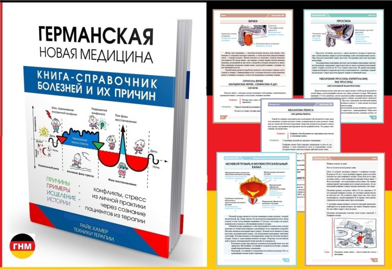 Простатит у мужчин, подробно о лечении.