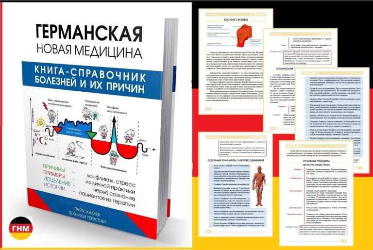 Боли в шее, приступы «остеохондроза»
