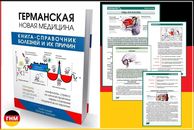 Тонзиллит / ангина / 3 причины
