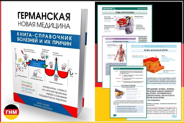 Астма и аллергия клинические примеры