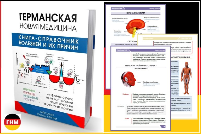 Первые симптомы инсульта причины