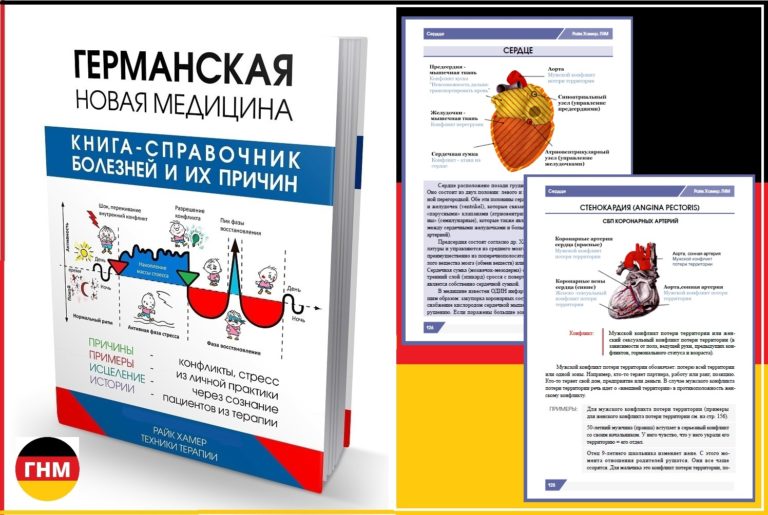 Сердечный приступ / инфаркт