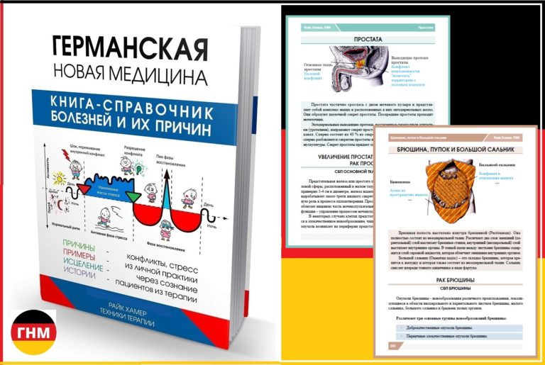 Рак простаты у мужчин симптомы