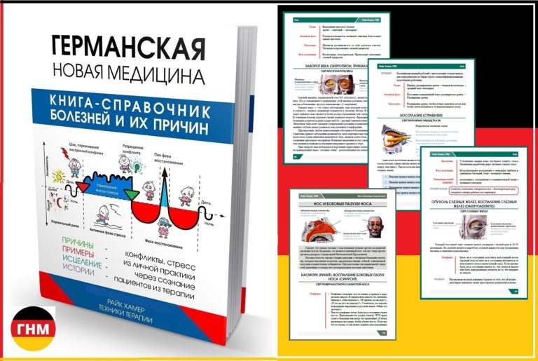 Глаукома что делать? Как я избавился