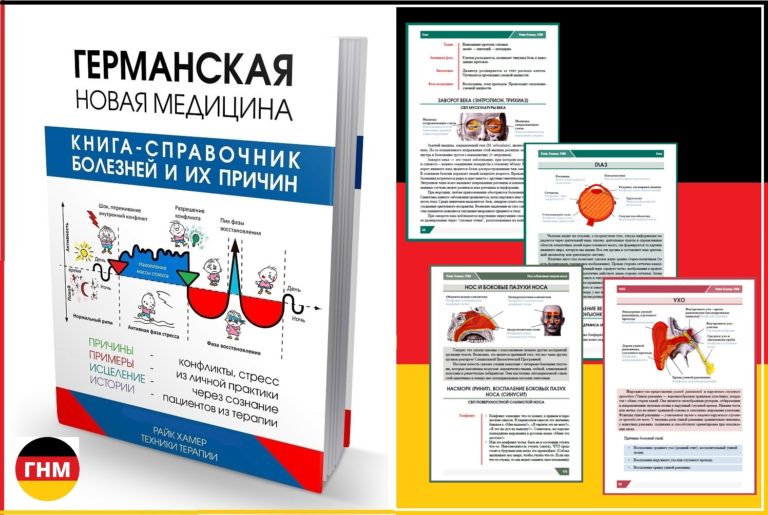 Глазная катаракта причины