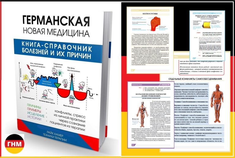 Болят колени сильно
