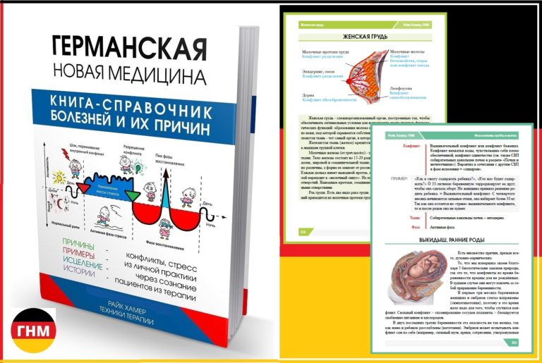 Родинка меланома