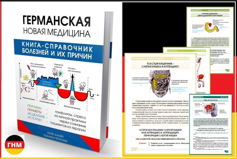 Как лечить гастрит
