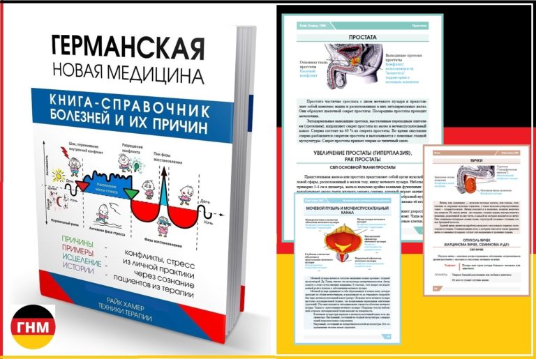 Аденома простаты симптомы