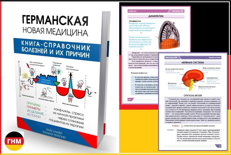 Как избавиться от эпилепсии