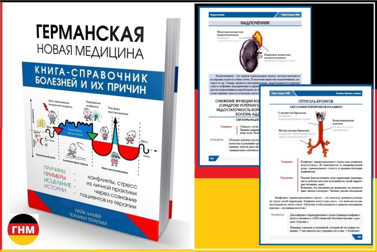 Синдромы почек / поражение