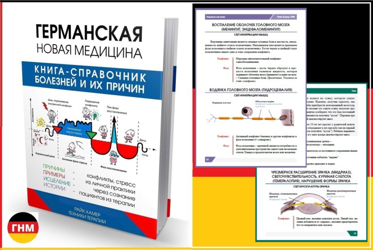 Причины нарушение зрения