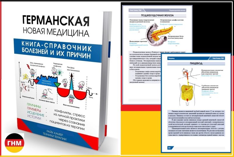 Рак прямой кишки симптомы