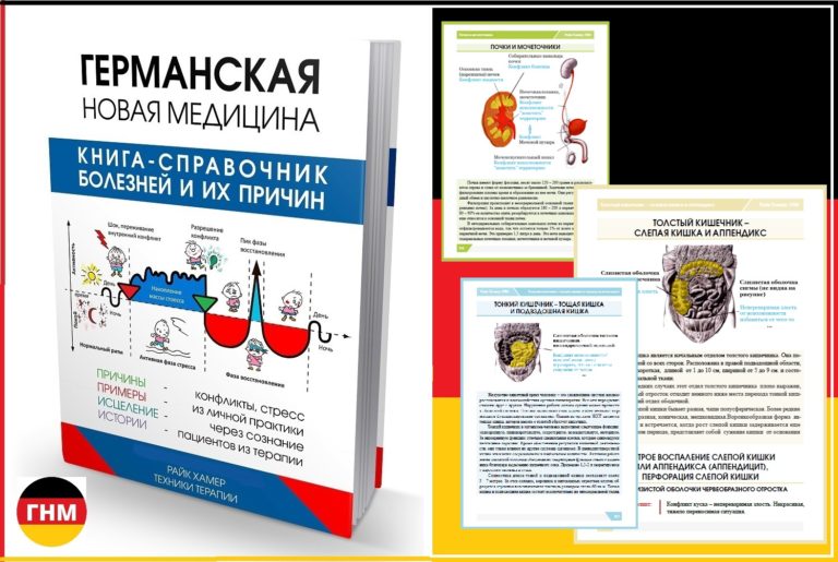 Язвенный колит кишечника