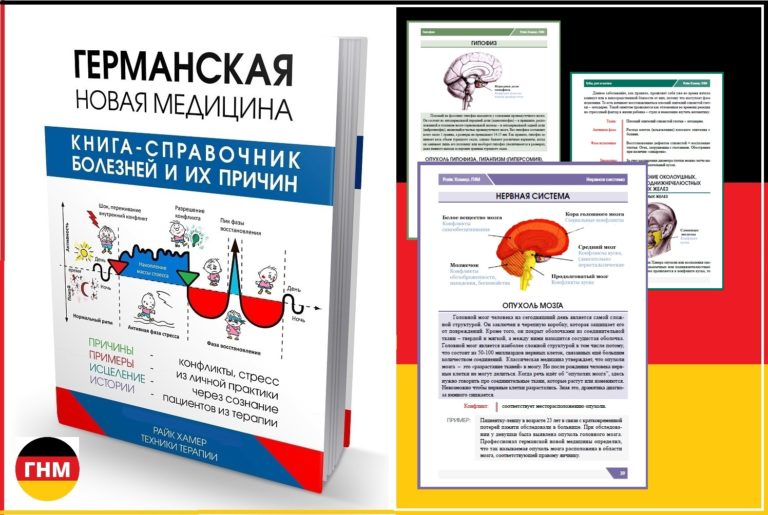 Признаки рассеянного склероза