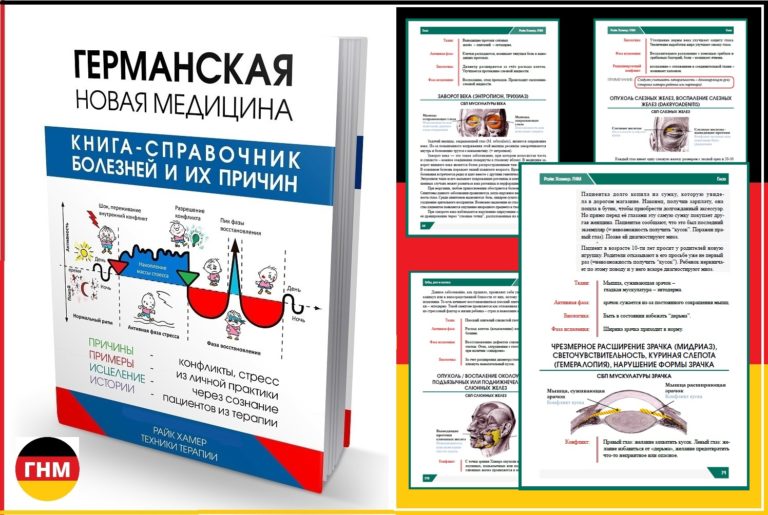 Причины миопии