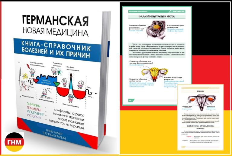 Миома матки без операции
