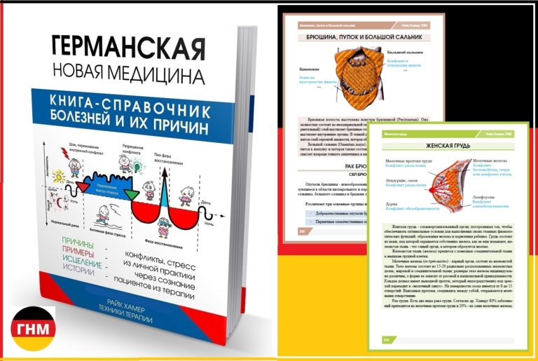 Геморрой причины возникновения