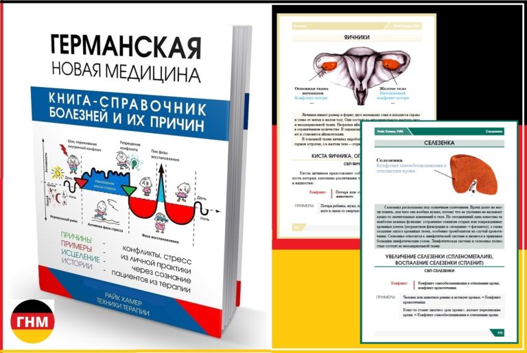 Эндометриоз гиперплазия эндометрия
