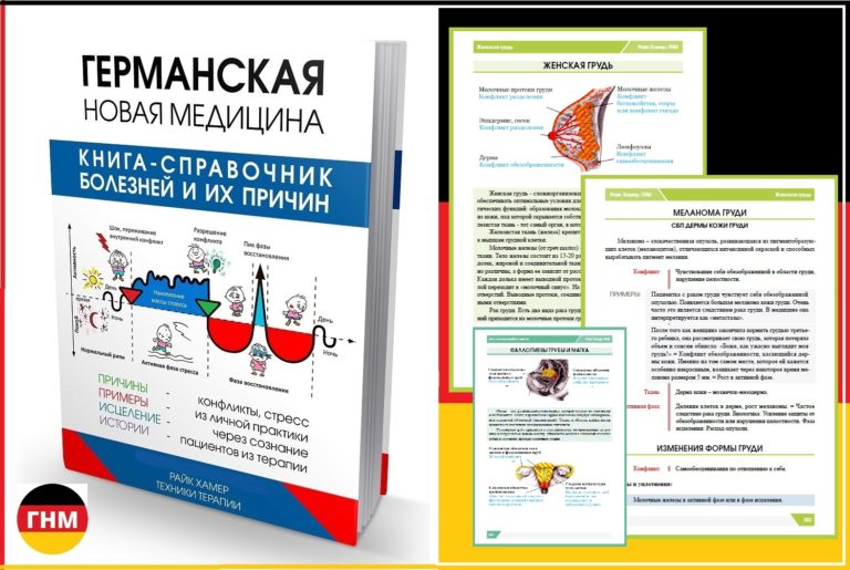 Кистозная мастопатия, рак железы