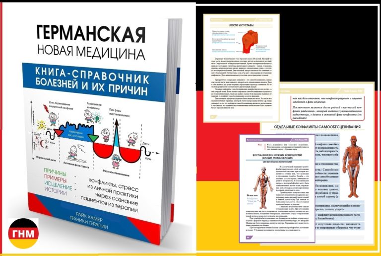 Ревматизм суставов