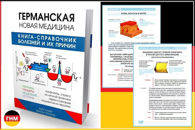 Бородавки как я избавилась