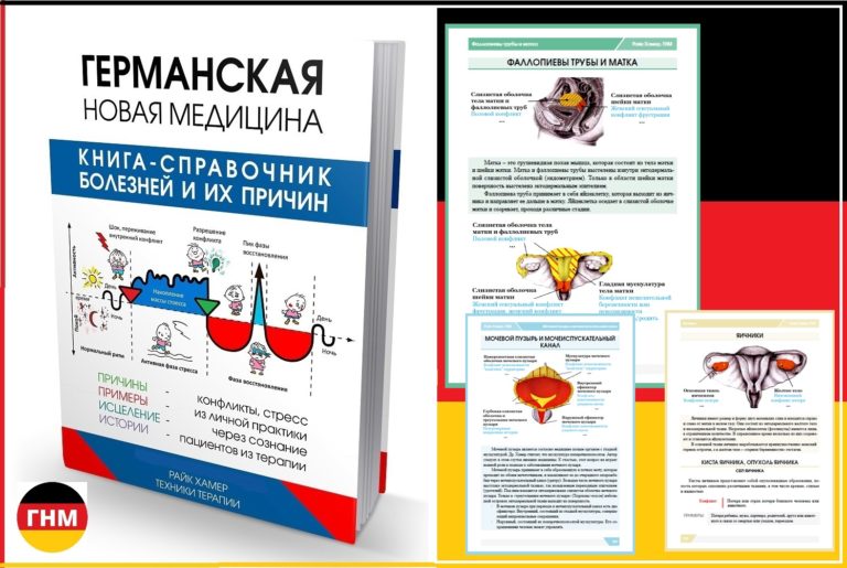 Рак шейки матки реальная история